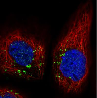 Immunocytochemistry/Immunofluorescence: VPS26 Antibody (CL2287) [NBP2-36754] - Staining in A431 cell line with Anti-VSP26A monoclonal antibody, showing distinct staining of endosomes in green. Microtubule- and nuclear probes are visualized in red and blue respectively (where available). Antibody staining is shown in green.