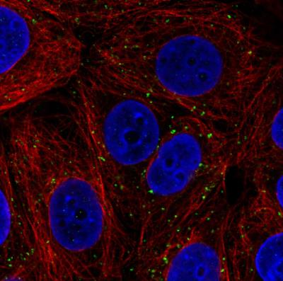 Immunocytochemistry/Immunofluorescence: VPS26 Antibody (CL2287) [NBP2-36754] - Staining in MCF7 cell line with Anti-VSP26A monoclonal antibody, showing distinct staining of endosomes in green. Microtubule- and nuclear probes are visualized in red and blue respectively (where available). Antibody staining is shown in green.