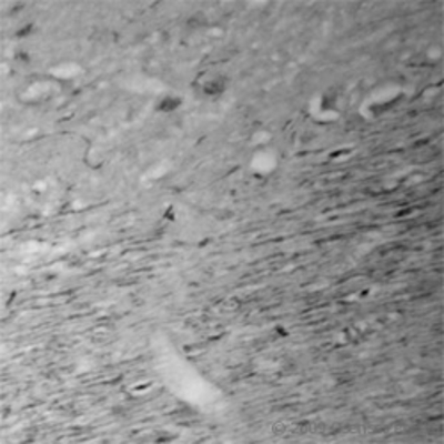 Immunohistochemistry: CACNA1I Antibody [NBP1-20109]-rat brain (paraffin section) using Rabbit antibody to a cytoplasmic domain of CACNA1I (Cav3.3): whole serum at 1 : 500 dilution incubated overnight at 4C. Nerve fibers are intensely stained.