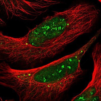 Immunocytochemistry/Immunofluorescence: BAP1 Antibody [NBP1-83149] - Staining of human cell line U-2 OS shows positivity in nucleus, nucleoli & vesicles.