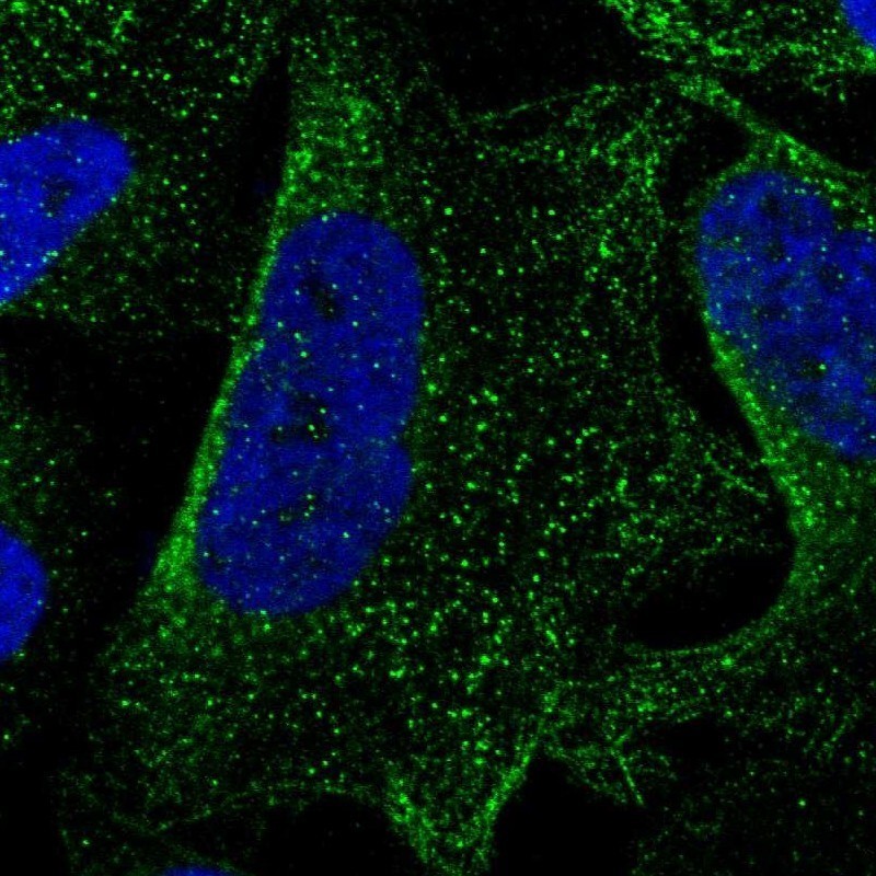 Immunocytochemistry/Immunofluorescence: C6orf64 Antibody [NBP1-83781] - Staining of human cell line U-2 OS shows positivity in vesicles.