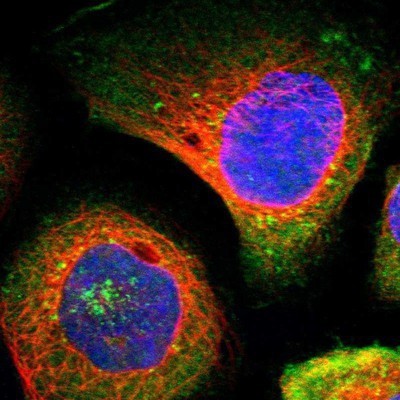Immunocytochemistry/Immunofluorescence: ARPC2 Antibody [NBP1-88852] - Staining of human cell line A-431 shows positivity in cytoplasm & golgi apparatus.