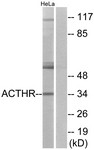 Western Blot: MC2 Receptor Antibody [NBP1-70996] - Analysis of extracts from HeLa cells, using MC2 Receptor Antibody. The lane on the right is treated with the synthesized peptide.