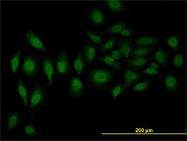 Immunocytochemistry/Immunofluorescence: SFRS3 Antibody (2D2) [H00006428-M08] - Immunofluorescence of monoclonal antibody to SFRS3 on HeLa cell . [antibody concentration 10 ug/ml]