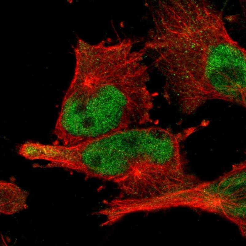 Immunocytochemistry/Immunofluorescence: BRD9 Antibody [NBP1-82256] - Staining of human cell line U-251MG shows positivity in nuclei but not nucleoli.