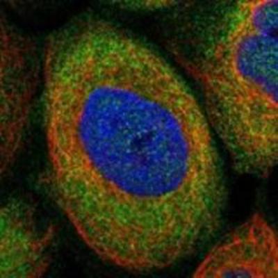 Immunocytochemistry/Immunofluorescence: MTHFD1 Antibody [NBP1-82610] - Staining of human cell line A-431 shows positivity in cytoplasm.