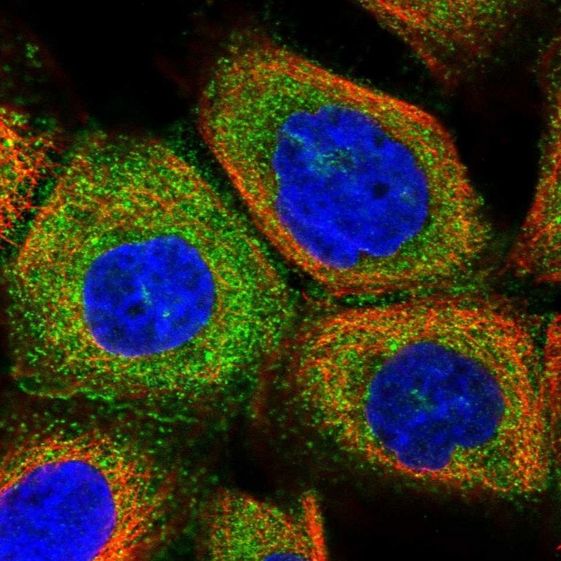 Immunocytochemistry/Immunofluorescence: HOMER3 Antibody [NBP2-32607] - Immunofluorescent staining of human cell line A-431 shows positivity in plasma membrane & cytoplasm.