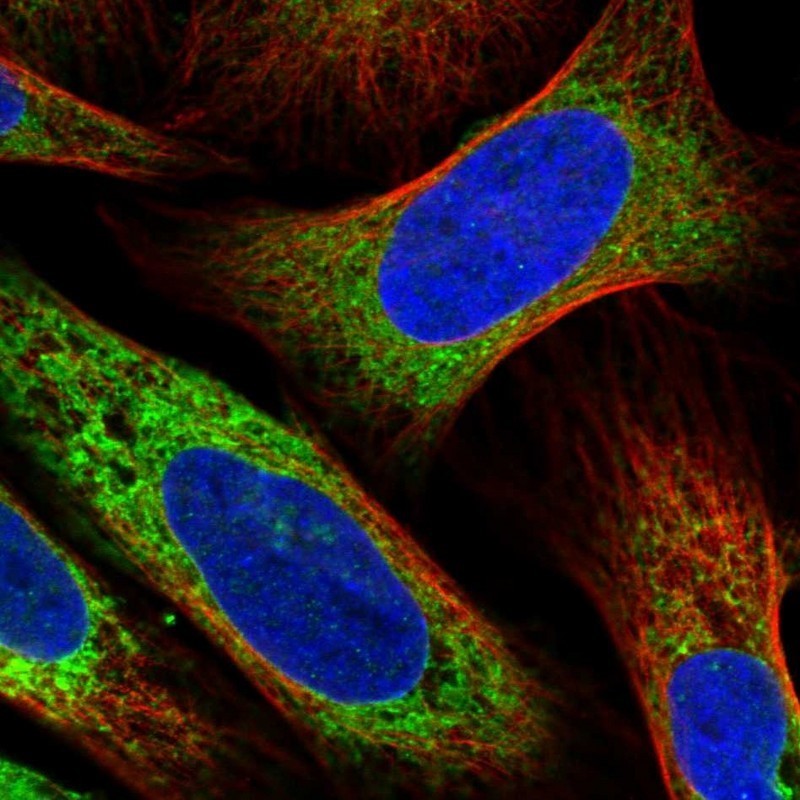 Immunocytochemistry/Immunofluorescence: RCN2 Antibody [NBP2-32011] - Immunofluorescent staining of human cell line U-2 OS shows positivity in endoplasmic reticulum.