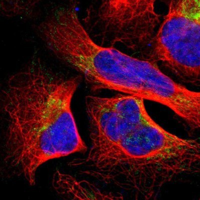 Immunocytochemistry/Immunofluorescence: SFXN3 Antibody [NBP1-87047] - Staining of human cell line U-2 OS shows positivity in mitochondria.