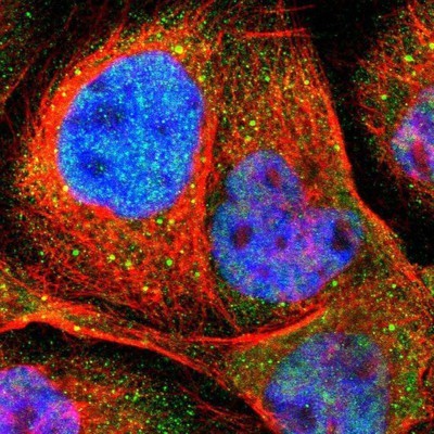 Immunocytochemistry/Immunofluorescence: Acetyl CoA synthetase Antibody [NBP1-90276] - Staining of human cell line A-431 shows positivity in nucleus but not nucleoli, cytoplasm & vesicles.