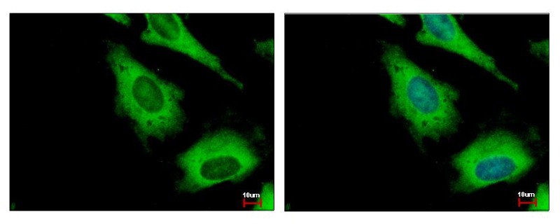 Immunocytochemistry/Immunofluorescence: IGF2BP2 Antibody [NBP1-33728] - Sample: HeLa cells were fixed in 4% paraformaldehyde at RT for 15 min. Green: IGF2BP2 protein stained by IGF2BP2 antibody diluted at 1:500. Blue: Hoechst 33343 staining.