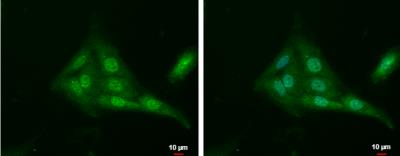 Immunocytochemistry/Immunofluorescence: Tubby Antibody [NBP2-20758] - SKNSH cells.