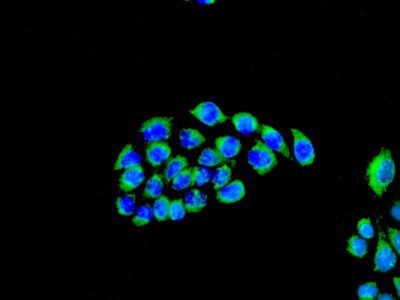 Immunocytochemistry/Immunofluorescence: PBR Antibody (EPR5384) [NBP1-95674] - Immunofluorescent analysis of A431 cells labeled with anti-TSPO.