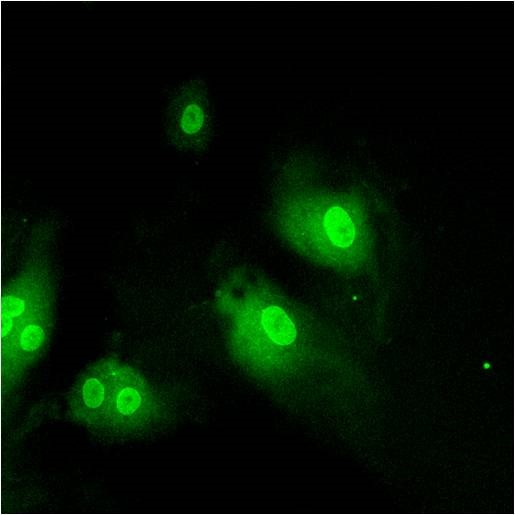 Immunocytochemistry/Immunofluorescence: Importin beta Antibody (3E9) [NB120-2811] - Staining in HMVEC Cells.