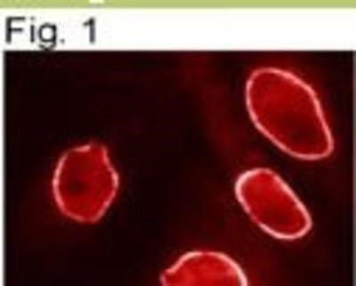 Immunocytochemistry/Immunofluorescence: Importin beta Antibody (3E9) [NB120-2811] - Immunolocalization of NTF97 in PTK cells.