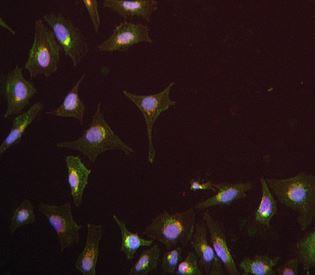 Immunocytochemistry/Immunofluorescence: IFITM3 Antibody (EPR5242) [NBP1-95757] - stained HeLa cells.