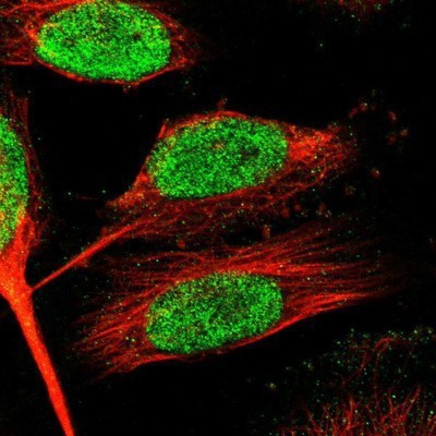 Immunocytochemistry/Immunofluorescence: ZNF24 Antibody [NBP1-82866] - Staining of human cell line U-251MG shows positivity in nucleus.