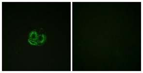 Immunocytochemistry/Immunofluorescence: pan Actin Antibody [NBP1-61498] - Analysis of HuvEc cells, using pan Actin ( alpha/gamma)  Antibody. The picture on the right is treated with the synthesized peptide.