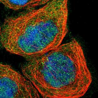 Immunocytochemistry/Immunofluorescence: SMAD4 Antibody [NBP1-84992] - staining of human cell line A-431 shows positivity in nucleus but not nucleoli, cytoplasm & centrosome.
