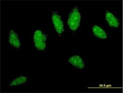 Immunocytochemistry/Immunofluorescence: CYLD Antibody (2C3) [H00001540-M01] - Analysis of monoclonal antibody to CYLD on HeLa cell. Antibody concentration 10 ug/ml.