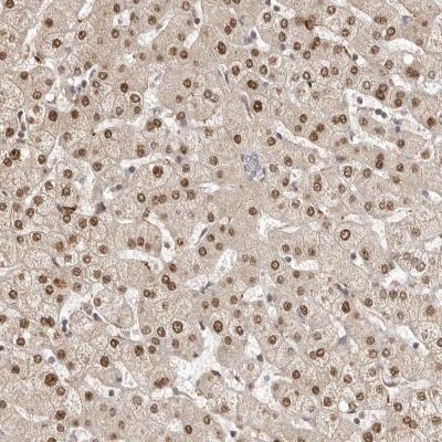 Immunohistochemistry: LCORL Antibody [NBP1-82036] - Staining of human liver shows nuclear positivity in hepatocytes.