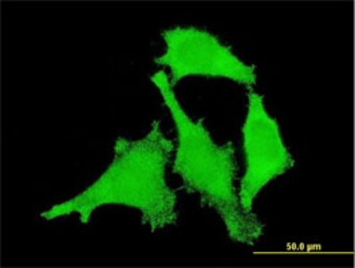 Immunocytochemistry/Immunofluorescence: ANKRD17 Antibody (1D12) [H00026057-M03] - Analysis of monoclonal antibody to ANKRD17 on HeLa cell. Antibody concentration 10 ug/ml
