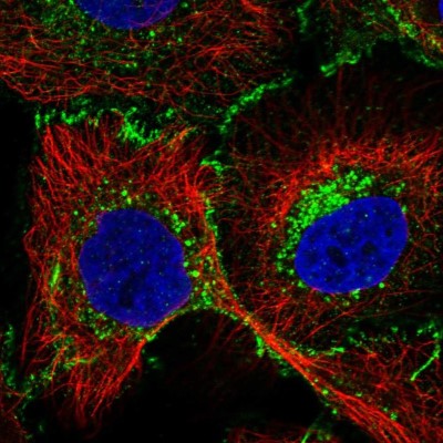 Immunocytochemistry/Immunofluorescence: SLC44A2 Antibody [NBP2-57838] - Staining of human cell line HaCaT shows localization to cell junctions & vesicles.