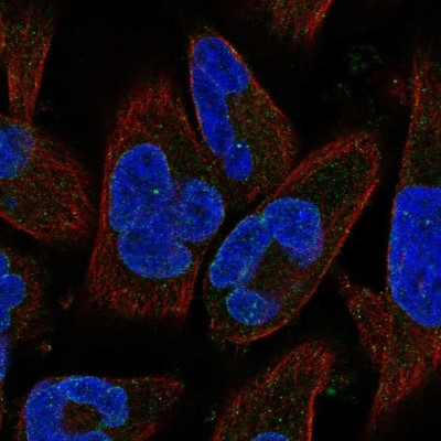 Immunocytochemistry/Immunofluorescence: Nesprin-3 Antibody [NBP2-57690] - Staining of human cell line RH-30 shows localization to nuclear membrane.