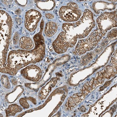 Immunohistochemistry-Paraffin: C10orf90 Antibody [NBP1-90793] - Staining of human kidney shows strong cytoplasmic positivity in cells in tubules.