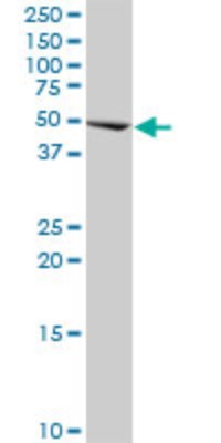 Western Blot: CBF1-interacting corepressor Antibody (2E11) [H00009541-M01] - CIR monoclonal antibody (M01), clone 2E11. Analysis of CIR expression in HeLa.