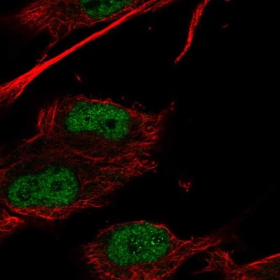 Immunocytochemistry/Immunofluorescence: HOXC9 Antibody [NBP2-58032] - Staining of human cell line SK-MEL-30 shows localization to nucleoplasm.