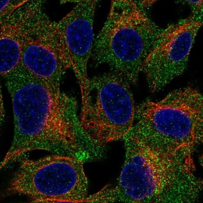Immunocytochemistry/Immunofluorescence: TRUSS Antibody [NBP2-57776] - Staining of human cell line Hep G2 shows localization to cytosol.