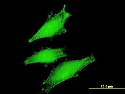 Immunocytochemistry/Immunofluorescence: FBXW11 Antibody (2E7) [H00023291-M03] - Analysis of monoclonal antibody to FBXW11 on HeLa cell. Antibody concentration 10 ug/ml