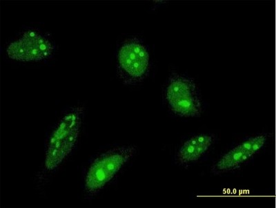 Immunocytochemistry/Immunofluorescence: ORC4L Antibody (2A8) [H00005000-M05] - Analysis of monoclonal antibody to ORC4L on HeLa cell. Antibody concentration 10 ug/ml