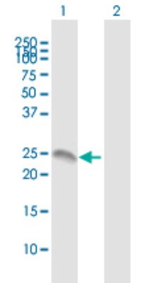 Western Blot: Annexin 2 Receptor Antibody [H00389289-B01P] - Analysis of ANXA2R expression in transfected 293T cell line by ANXA2R polyclonal antibody.  Lane 1: ANXA2R transfected lysate(21.23 KDa). Lane 2: Non-transfected lysate.