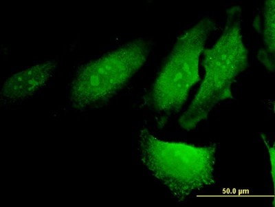 Immunocytochemistry/Immunofluorescence: RERG Antibody (1C5) [H00085004-M03] - Analysis of monoclonal antibody to RERG on HeLa cell. Antibody concentration 10 ug/ml