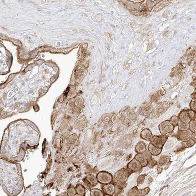 Immunodiffusion: C4orf21/prematurely terminated mRNA decay factor-like Antibody [NBP1-83750] - Staining of human placenta shows moderate cytoplasmic and membranous positivity in decidual and trophoblastic cells.