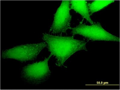 Immunocytochemistry/Immunofluorescence: MAP3K12 binding inhibitory protein 1 Antibody (2E2) [H00051562-M05] - Analysis of monoclonal antibody to MBIP on HeLa cell. Antibody concentration 10 ug/ml