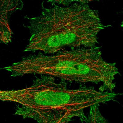 Immunocytochemistry/Immunofluorescence: Drosha Antibody [NBP2-58421] - Staining of human cell line SiHa shows localization to nucleoplasm, plasma membrane & focal adhesion sites.