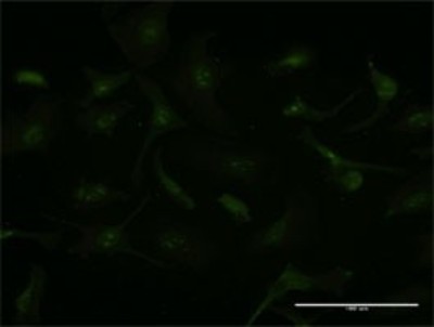 Immunocytochemistry/Immunofluorescence: GCHFR Antibody (4G6) [H00002644-M01] - Analysis of monoclonal antibody to GCHFR on HeLa cell. Antibody concentration 20 ug/ml.