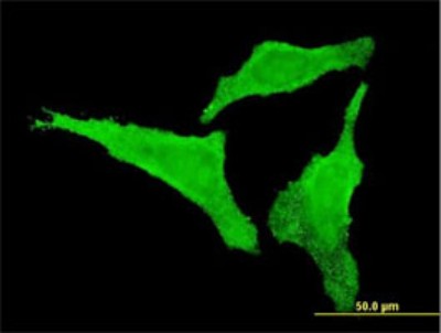 Immunocytochemistry/Immunofluorescence: CDKL2 Antibody (6H8) [H00008999-M02] - Analysis of monoclonal antibody to CDKL2 on HeLa cell. Antibody concentration 10 ug/ml.