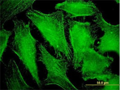 Immunocytochemistry/Immunofluorescence: CDC42BPB Antibody (5F12) [H00009578-M01] - Analysis of monoclonal antibody to CDC42BPB on HeLa cell. Antibody concentration 10 ug/ml.