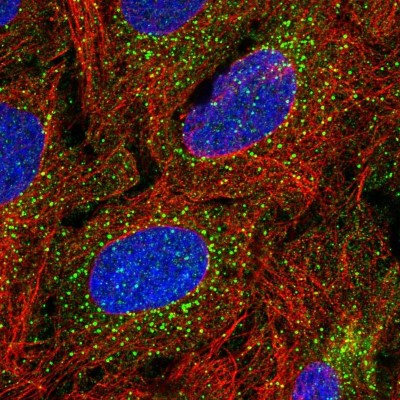Immunocytochemistry/Immunofluorescence: TBX4 Antibody [NBP2-58490] - Staining of human cell line U-2 OS shows localization to vesicles.