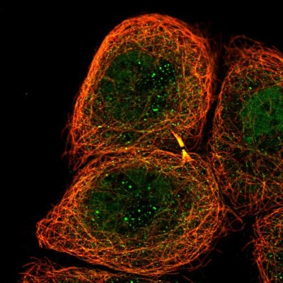 Immunocytochemistry/Immunofluorescence: ZNF238 Antibody [NBP2-58569] - Staining of human cell line A-431 shows localization to nucleoplasm, microtubules & cytokinetic bridge.