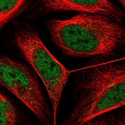 Immunocytochemistry/Immunofluorescence: SART2 Antibody [NBP2-58454] - Staining of human cell line U-2 OS shows localization to nucleoplasm & cytosol.