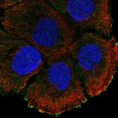 Immunocytochemistry/Immunofluorescence: ATP2C2 Antibody [NBP2-56535] - Staining of human cell line HaCaT shows localization to plasma membrane & focal adhesion sites.