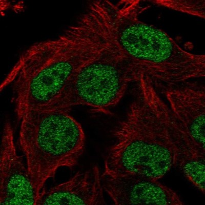 Immunocytochemistry/Immunofluorescence: ST6GALNAC3 Antibody [NBP2-56726] - Staining of human cell line SK-MEL-30 shows localization to nucleoplasm.