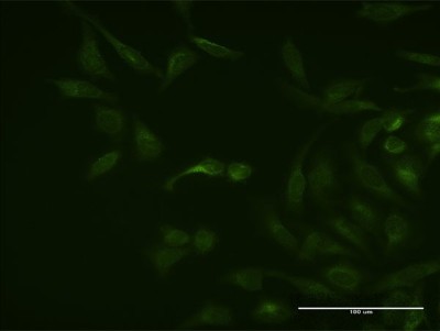 Immunocytochemistry/Immunofluorescence: ASB3 Antibody (3E5) [H00051130-M21] - Analysis of monoclonal antibody to ASB3 on HeLa cell. Antibody concentration 40 ug/ml