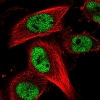 Immunocytochemistry/Immunofluorescence: RBM15B Antibody [NBP2-58773] - Staining of human cell line U-251 MG shows localization to nucleoplasm.