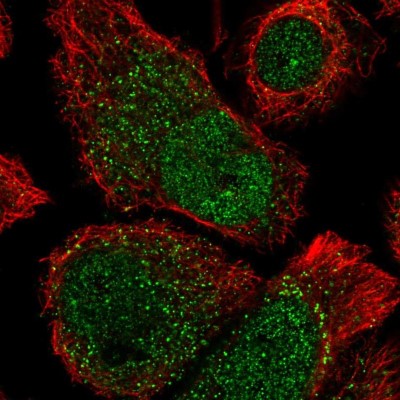 Immunocytochemistry/Immunofluorescence: ANKRD37 Antibody [NBP2-58724] - Staining of human cell line PC-3 shows localization to nucleus & cytosol.